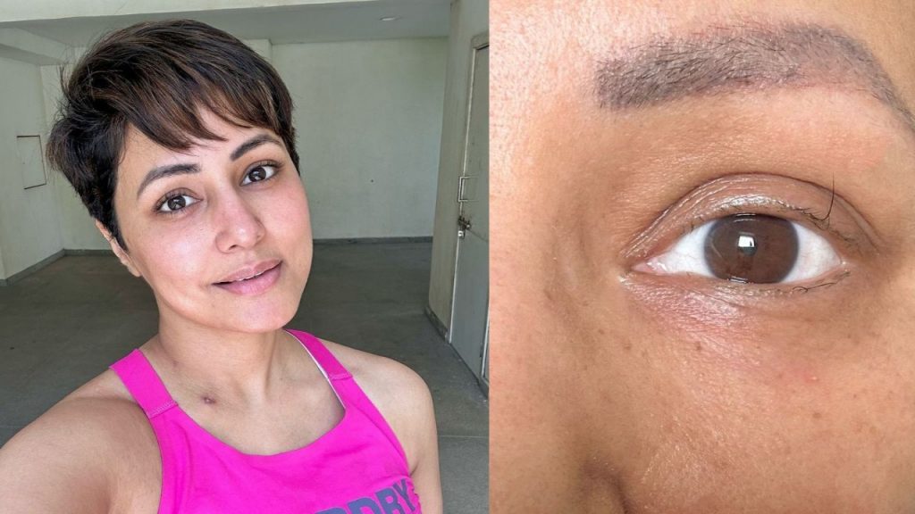 Hina Khan finds motivation in her 'last standing eyelash' as she courageously battles breast cancer