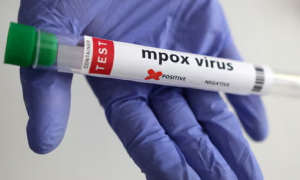 US confirms first case of clade I mpox in California