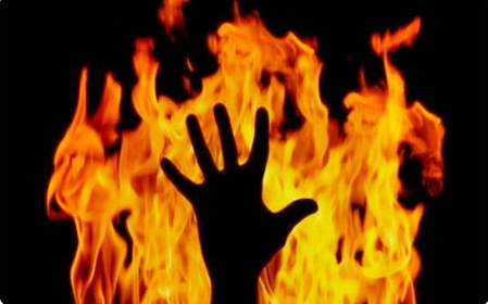 Pakistani woman set ablaze by husband for objecting to his extramarital affairs