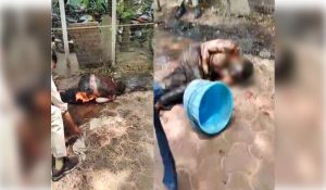 MP: Man set himself on fire in Bhopal, admitted to hospital with over 40 pc burn injuries