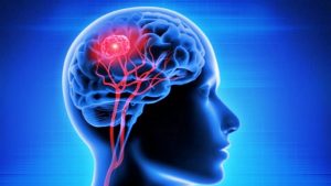 Scientists find drugs with potential to treat neurodegenerative disorders