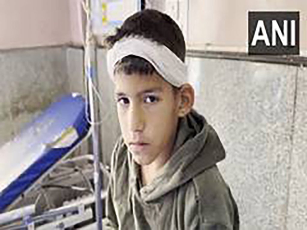 Young boy injured in Baramulla as Pakistan continues ceasefire violations, targets civilians in border areas