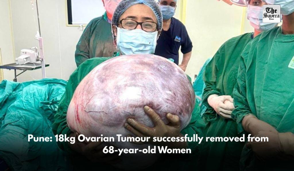 Pune: 18kg Ovarian Tumour successfully removed from 68-year-old Women