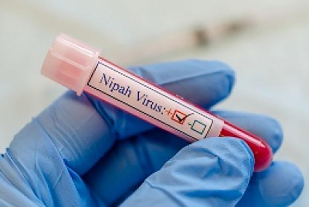 Nipah-positive