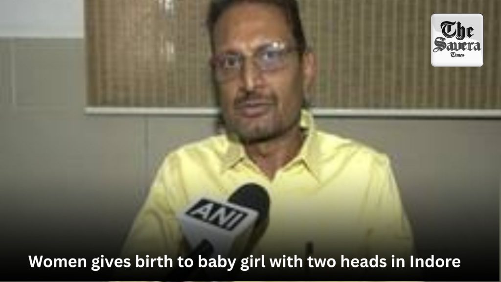 baby girl with two heads