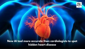 New AI tool more accurate than cardiologists to spot hidden heart disease