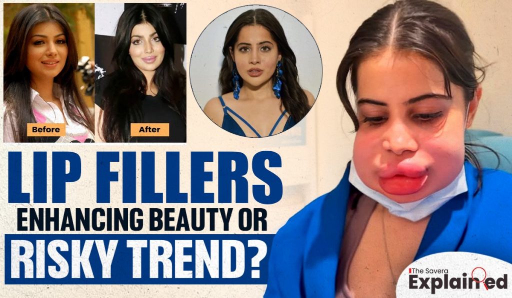 Lip Fillers: Enhancing Beauty or Risky Trend?