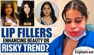 Lip Fillers: Enhancing Beauty or Risky Trend?