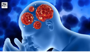 Kerala on alert: Deadly brain-eating amoeba claims 42 lives with 170 cases reported in 2025