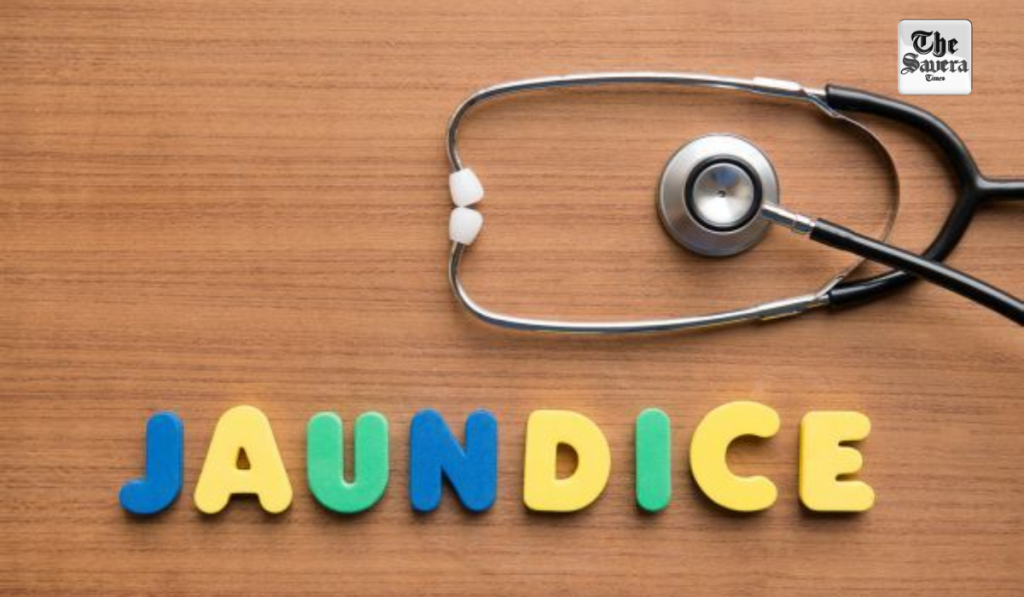 Jaundice Cases Rise in Himachal’s Hamirpur; 39 Infected Including 14 Students