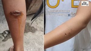 Monkey Attacks in Lucknow Leave Residents Terrified