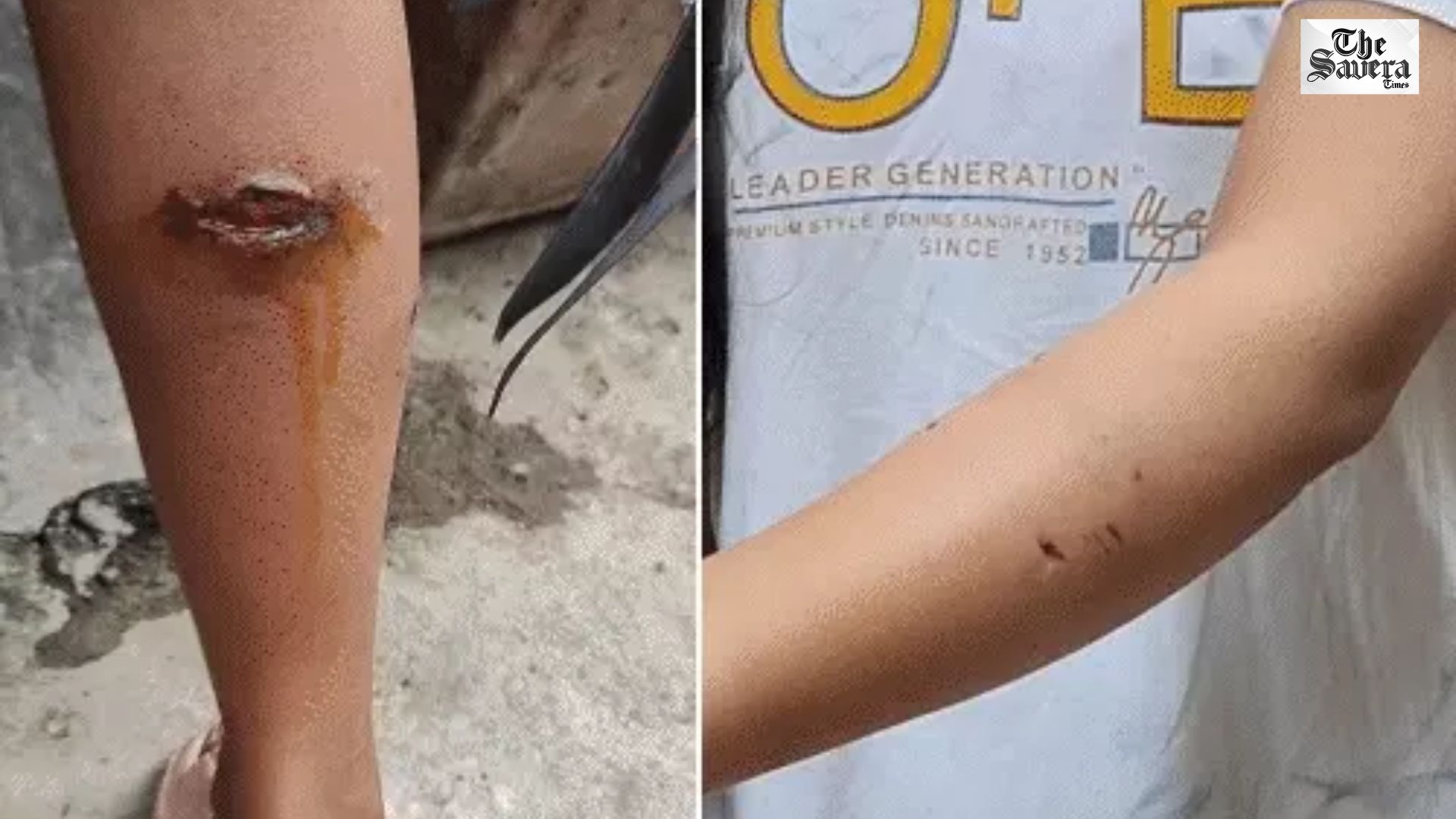 Monkey Attacks in Lucknow Leave Residents Terrified