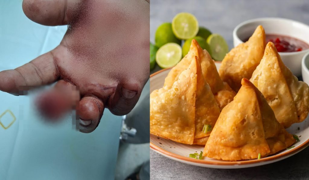samosa brawl mumbai
