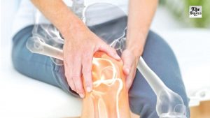The Gel that Can Fight Arthritis Pain