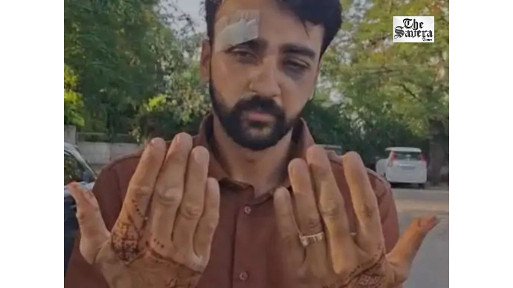 Jaipur Road Rage: Man Injured After Car Clash