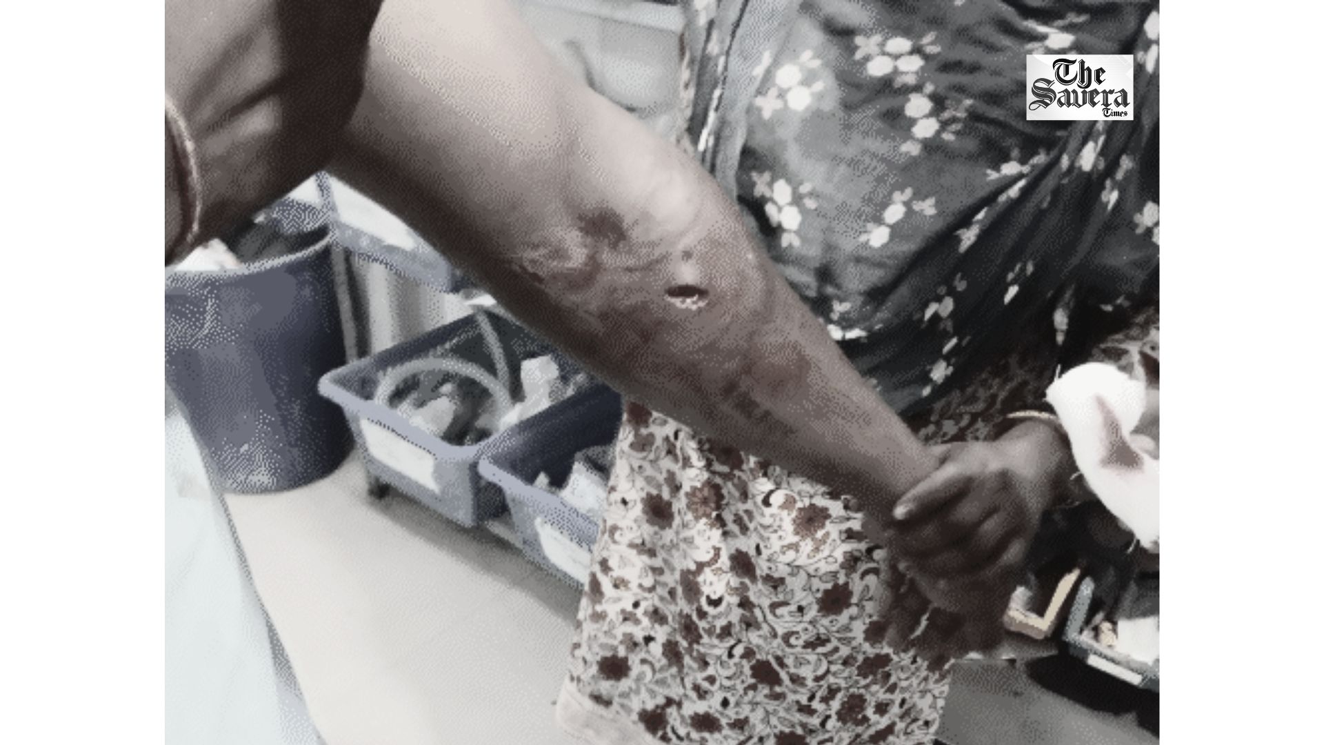Ludhiana: Man Attacked with Sharp Weapon, Activa and Mobile Looted Near Jalandhar Bypass