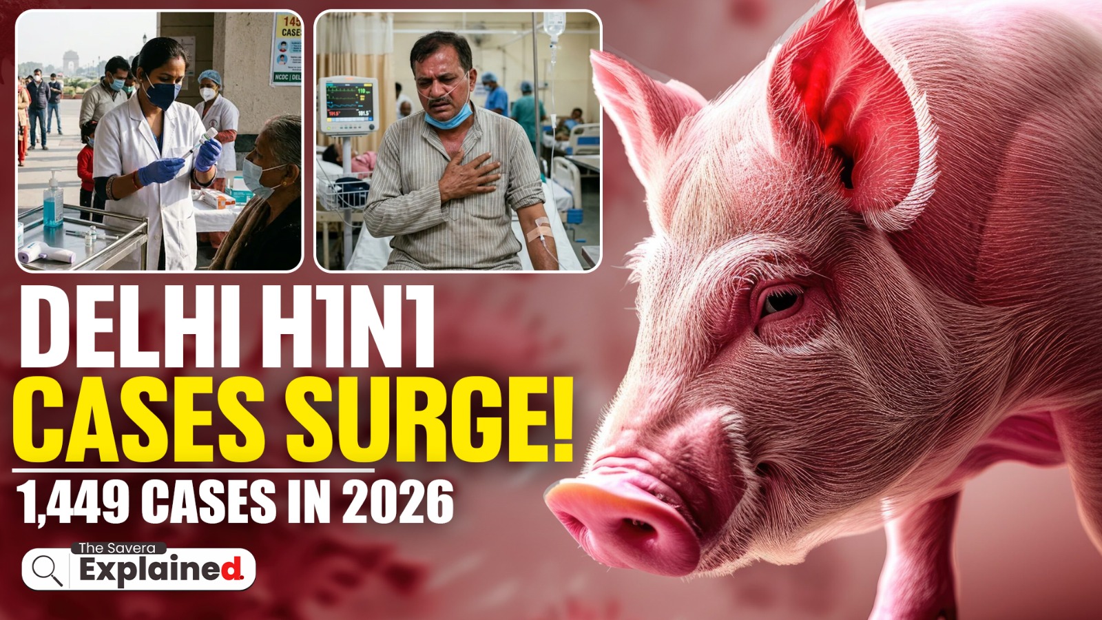 Delhi H1N1 Cases Surge 6X: 1,449 Cases Reported, Know Symptoms, Warning Signs & When to See a Doctor